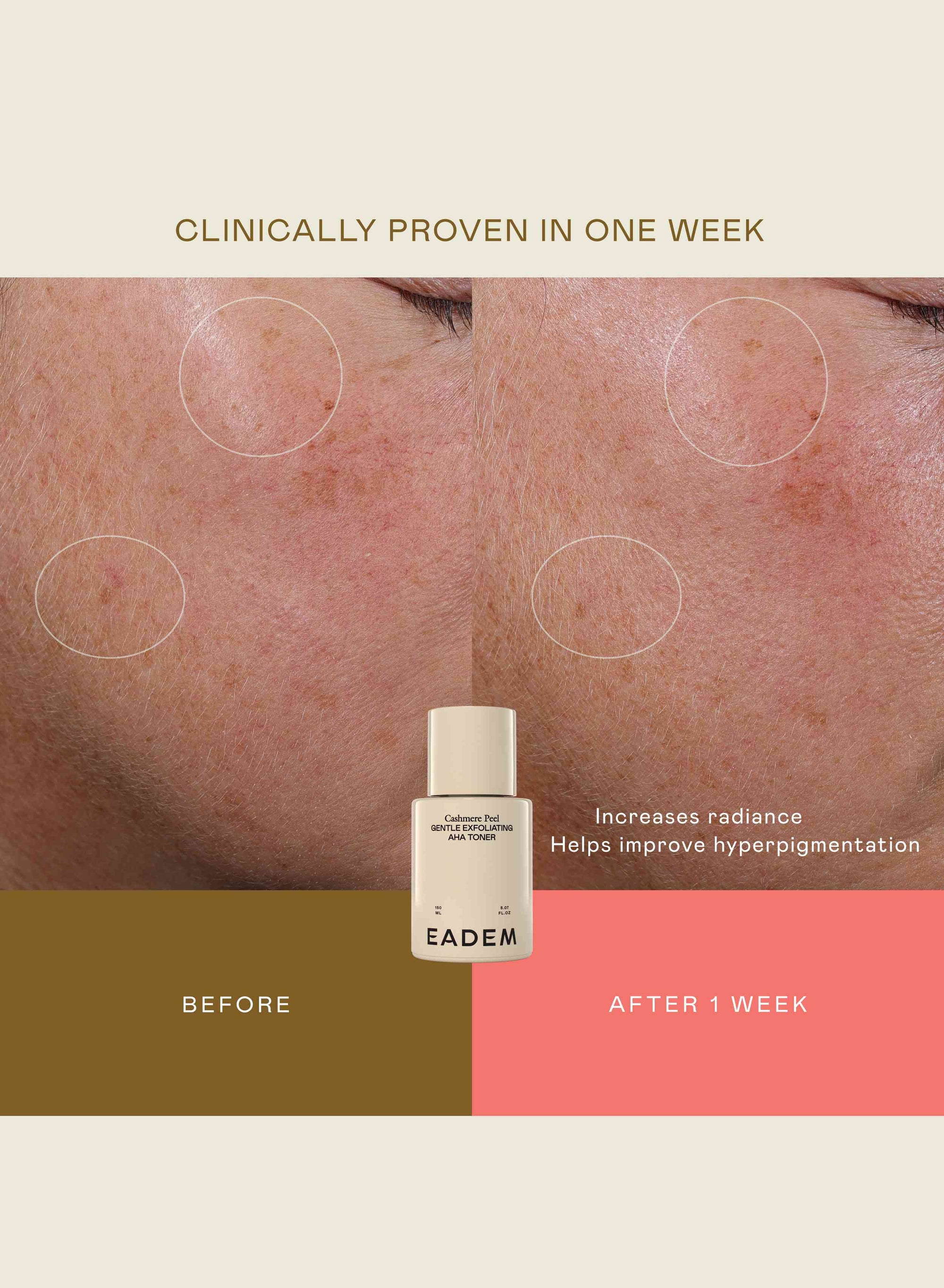 eadem cashmere peel