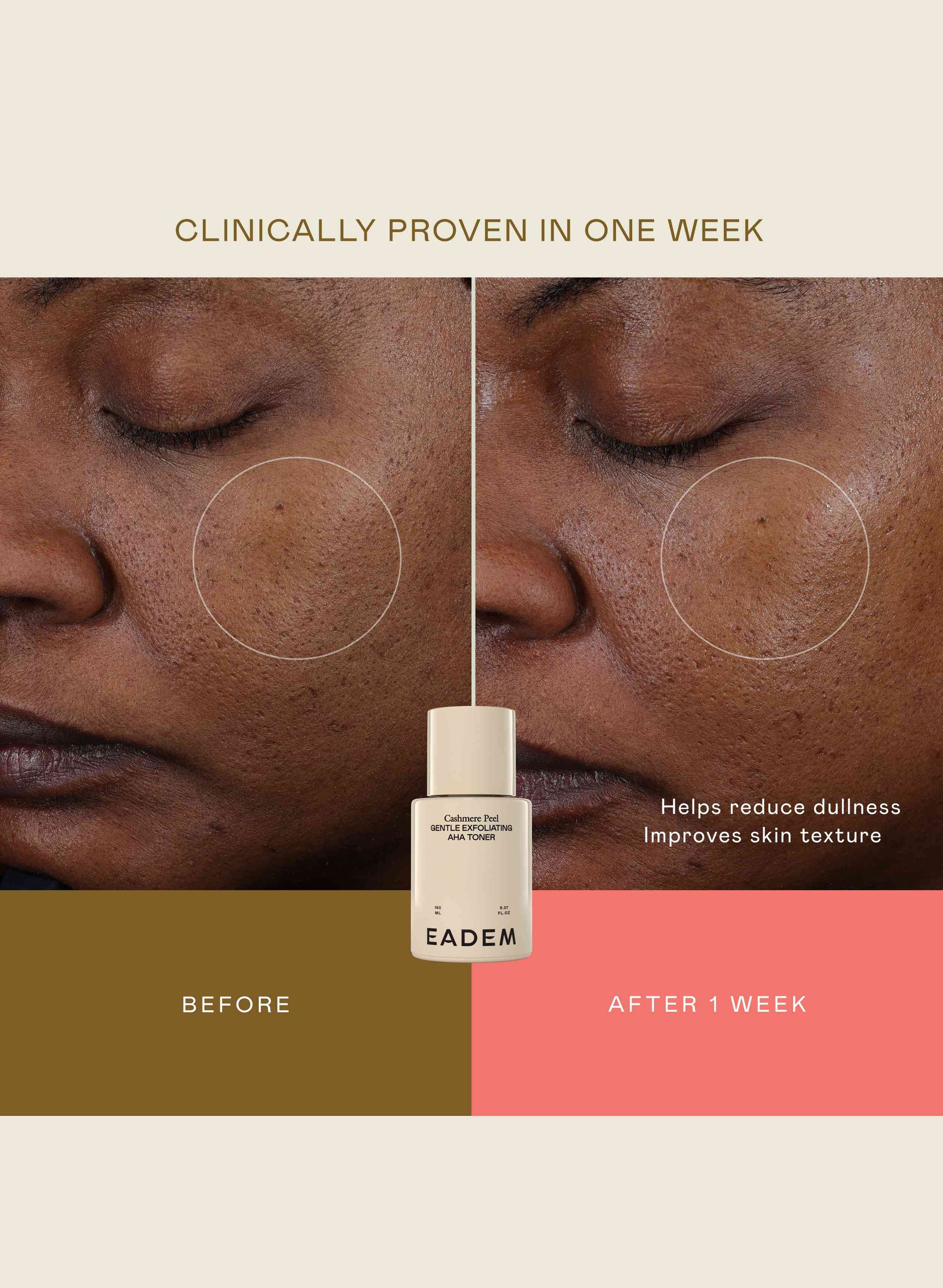 eadem cashmere peel