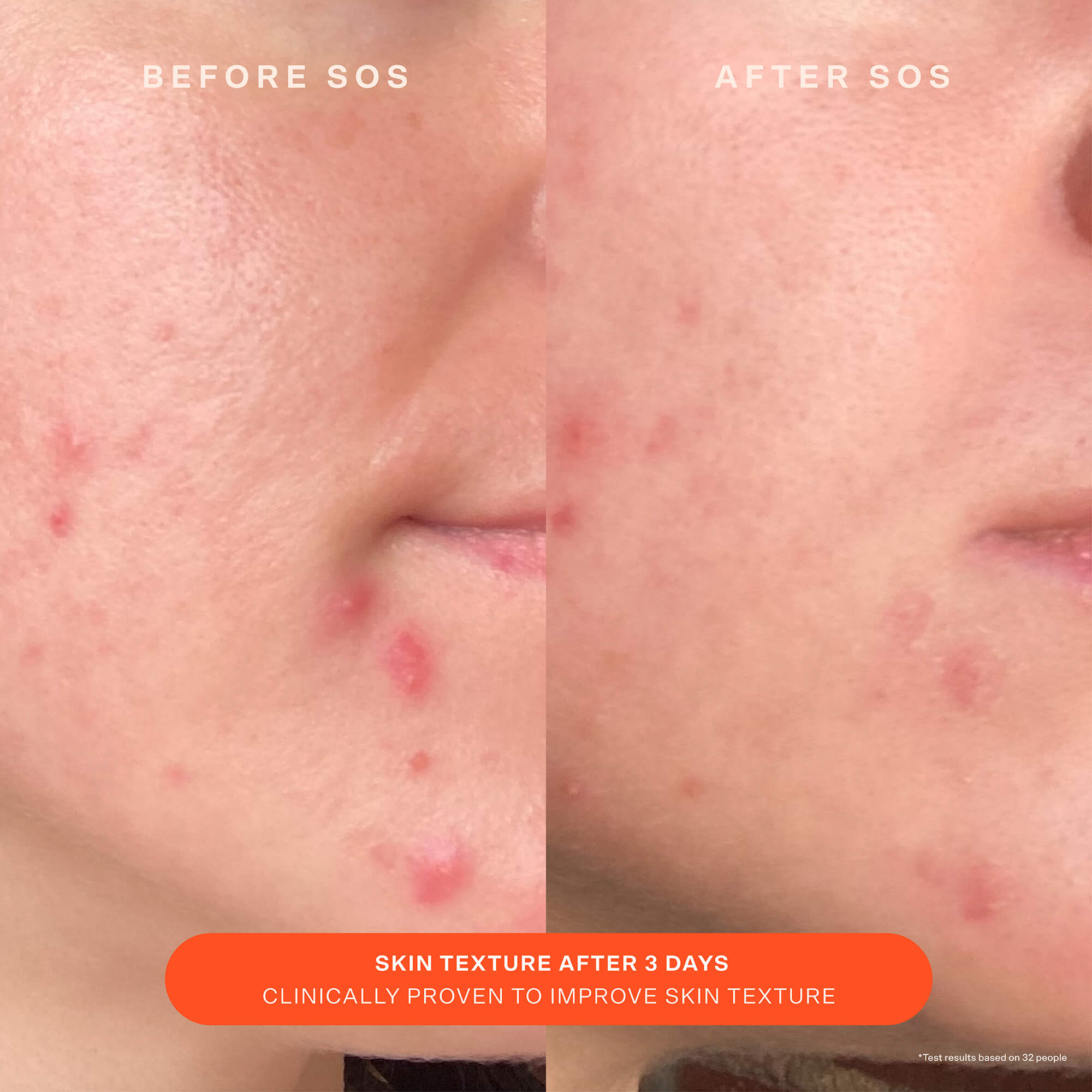 tower 28 sos recovery cream jumbo