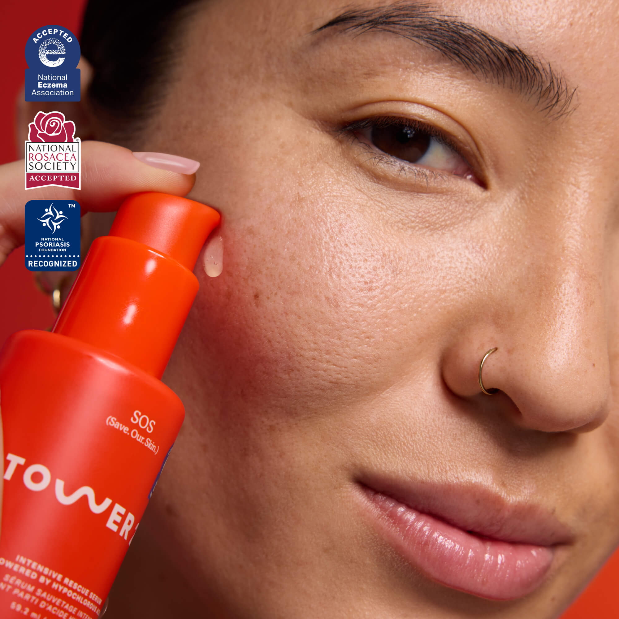 tower 28 sos rescue serum